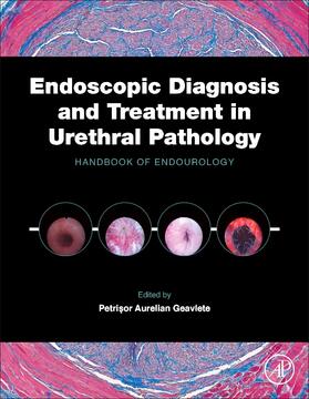 Geavlete |  Endoscopic Diagnosis and Treatment in Urethral Pathology | Buch |  Sack Fachmedien