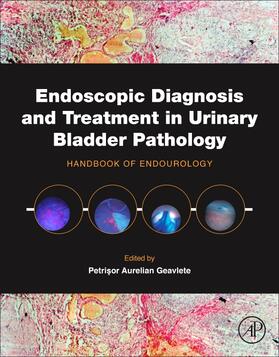 Geavlete |  Endoscopic Diagnosis and Treatment in Urinary Bladder Pathol | Buch |  Sack Fachmedien
