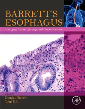 Pleskow / Erim |  Barrett's Esophagus | Buch |  Sack Fachmedien