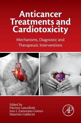 Lancellotti / Galderisi |  Anticancer Treatments and Cardiotoxicity | eBook | Sack Fachmedien