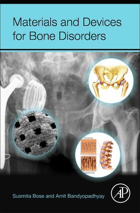 Bose / Bandyopadhyay |  Materials and Devices for Bone Disorders | Buch |  Sack Fachmedien