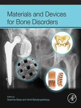 Bose / Bandyopadhyay |  Materials and Devices for Bone Disorders | eBook | Sack Fachmedien