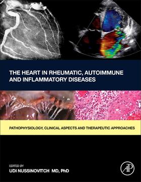 Nussinovitch |  The Heart in Rheumatic, Autoimmune and Inflammatory Diseases | Buch |  Sack Fachmedien