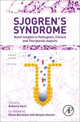 Alessia / Alunno / Bartoloni |  Sjogren's Syndrome | Buch |  Sack Fachmedien