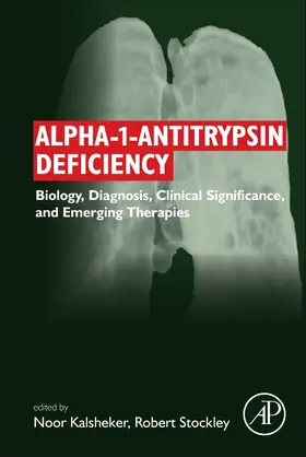 Kalsheker / Stockley |  Alpha-1-Antitrypsin Deficiency | Buch |  Sack Fachmedien