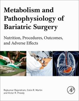 Rajendram / Preedy / Martin |  Metabolism and Pathophysiology of Bariatric Surgery | Buch |  Sack Fachmedien