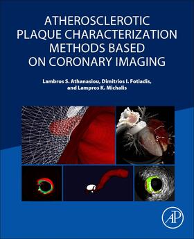 Athanasiou / Fotiadis / Michalis |  Atherosclerotic Plaque Characterization Methods Based on Coronary Imaging | Buch |  Sack Fachmedien
