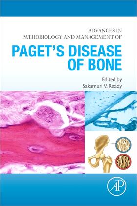 Reddy |  Advances in Pathobiology and Management of Paget's Disease of Bone | Buch |  Sack Fachmedien