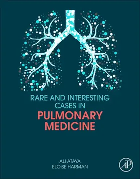 Ataya / Harman |  Rare and Interesting Cases in Pulmonary Medicine | Buch |  Sack Fachmedien