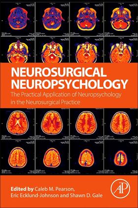 Pearson / Ecklund-Johnson / Gale |  Neurosurgical Neuropsychology | Buch |  Sack Fachmedien