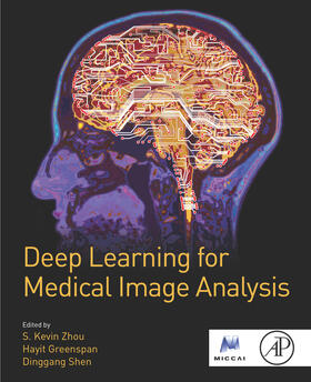 Greenspan / Shen |  Deep Learning for Medical Image Analysis | eBook | Sack Fachmedien