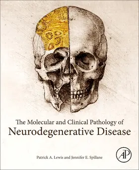 Lewis / Spillane |  The Molecular and Clinical Pathology of Neurodegenerative Disease | Buch |  Sack Fachmedien