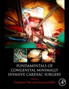 Vida / Stellin |  Fundamentals of Congenital Minimally Invasive Cardiac Surgery | Buch |  Sack Fachmedien