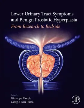 Morgia / Russo |  Lower Urinary Tract Symptoms and Benign Prostatic Hyperplasia | Buch |  Sack Fachmedien