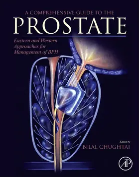 Chughtai |  A Comprehensive Guide to the Prostate | Buch |  Sack Fachmedien