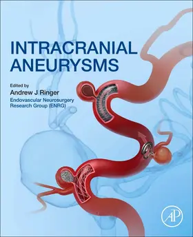 Ringer |  Intracranial Aneurysms | Buch |  Sack Fachmedien