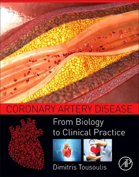 Tousoulis |  Coronary Artery Disease | Buch |  Sack Fachmedien