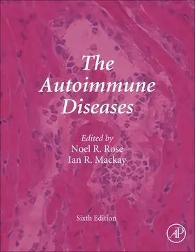 Gershwin / Tsokos |  The Autoimmune Diseases | Buch |  Sack Fachmedien