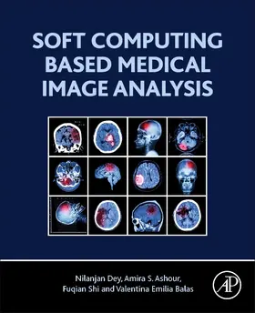 Dey / Ashour / Shi |  Soft Computing Based Medical Image Analysis | Buch |  Sack Fachmedien