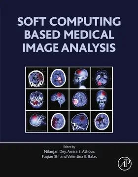 Dey / Ashour / Shi |  Soft Computing Based Medical Image Analysis | eBook | Sack Fachmedien