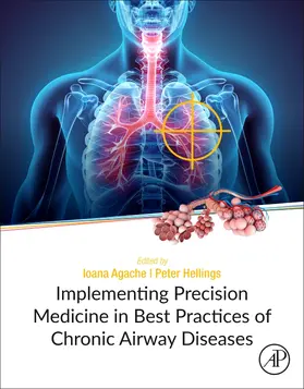 Agache / Hellings |  Implementing Precision Medicine in Best Practices of Chronic Airway Diseases | Buch |  Sack Fachmedien