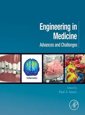 Iaizzo |  Engineering in Medicine | eBook | Sack Fachmedien