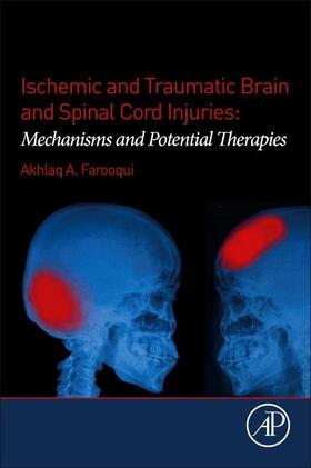 Farooqui |  Ischemic and Traumatic Brain and Spinal Cord Injuries | Buch |  Sack Fachmedien