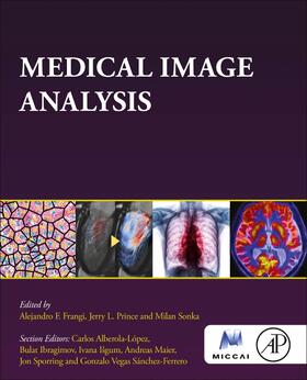 Frangi / Prince / Sonka |  Medical Image Analysis | Buch |  Sack Fachmedien