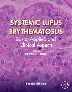 Tsokos | Systemic Lupus Erythematosus | Buch | 978-0-12-814551-7 | sack.de