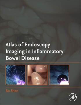 Shen |  Atlas of Endoscopy Imaging in Inflammatory Bowel Disease | Buch |  Sack Fachmedien