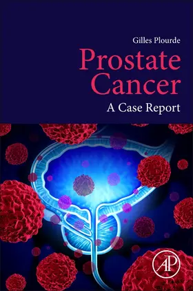 Plourde |  Prostate Cancer | Buch |  Sack Fachmedien