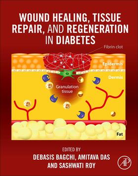 Bagchi / Das / Roy |  Wound Healing, Tissue Repair, and Regeneration in Diabetes | Buch |  Sack Fachmedien