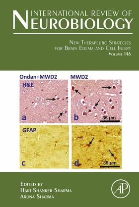 Sharma |  New Therapeutic Strategies for Brain Edema and Cell Injury | eBook | Sack Fachmedien