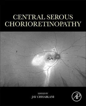 Chhablani |  Central Serous Chorioretinopathy | Buch |  Sack Fachmedien