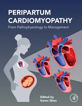 Sliwa |  Peripartum Cardiomyopathy | Buch |  Sack Fachmedien