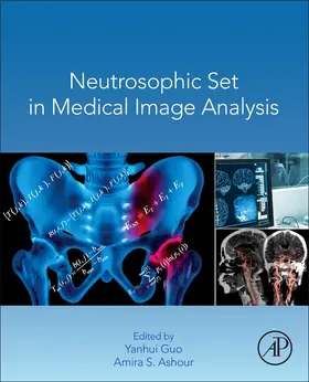 Guo / Ashour |  Neutrosophic Set in Medical Image Analysis | Buch |  Sack Fachmedien