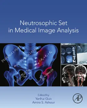 Guo / Ashour |  Neutrosophic Set in Medical Image Analysis | eBook | Sack Fachmedien