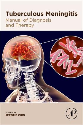 Chin |  Tuberculous Meningitis | Buch |  Sack Fachmedien