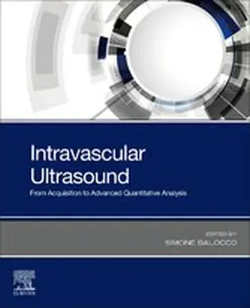 Balocco |  Intravascular Ultrasound | eBook | Sack Fachmedien