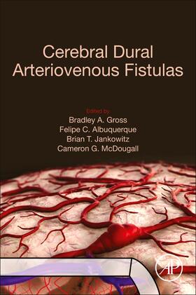 Gross / Jankowitz / Albuquerque |  Cerebral Dural Arteriovenous Fistulas | Buch |  Sack Fachmedien