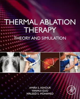 Ashour / Guo / Mohamed | Thermal Ablation Therapy | Buch | 978-0-12-819544-4 | sack.de