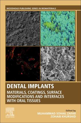 Zafar / Khurshid |  Dental Implants: Materials, Coatings, Surface Modifications and Interfaces with Oral Tissues | Buch |  Sack Fachmedien