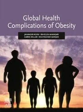 Moini / Ahangari / Miller |  Global Health Complications of Obesity | eBook | Sack Fachmedien