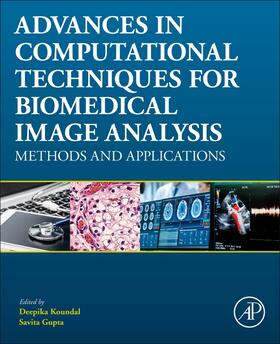 Koundal / Gupta |  Advances in Computational Techniques for Biomedical Image Analysis: Methods and Applications | Buch |  Sack Fachmedien