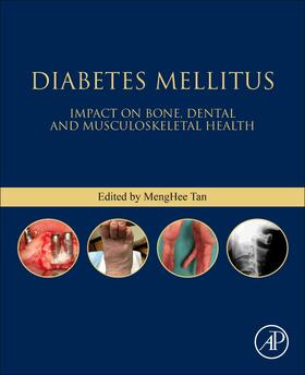 Tan |  Diabetes Mellitus | Buch |  Sack Fachmedien