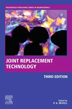 Revell |  Joint Replacement Technology | Buch |  Sack Fachmedien