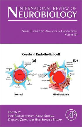 Novel Therapeutic Advances in Glioblastoma | Buch | 978-0-12-821114-4 | sack.de