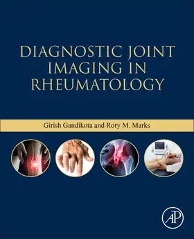 Gandikota / Marks |  Diagnostic Joint Imaging in Rheumatology | Buch |  Sack Fachmedien