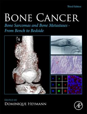 Heymann |  Bone Cancer | Buch |  Sack Fachmedien