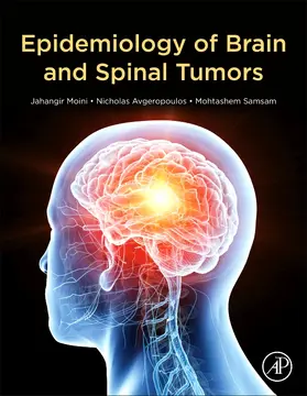 Moini / Avgeropoulos / Samsam |  Epidemiology of Brain and Spinal Tumors | Buch |  Sack Fachmedien